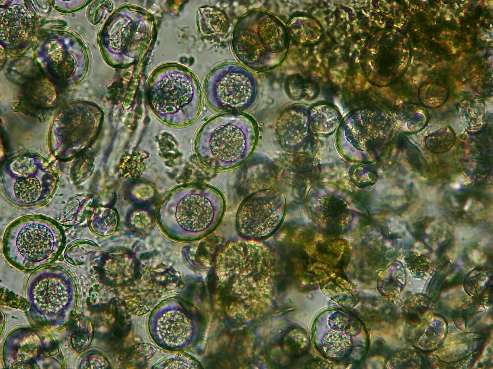 Vajíčka parazita Isospora sp. pod mikroskopom pri koprologickom vyšetrení